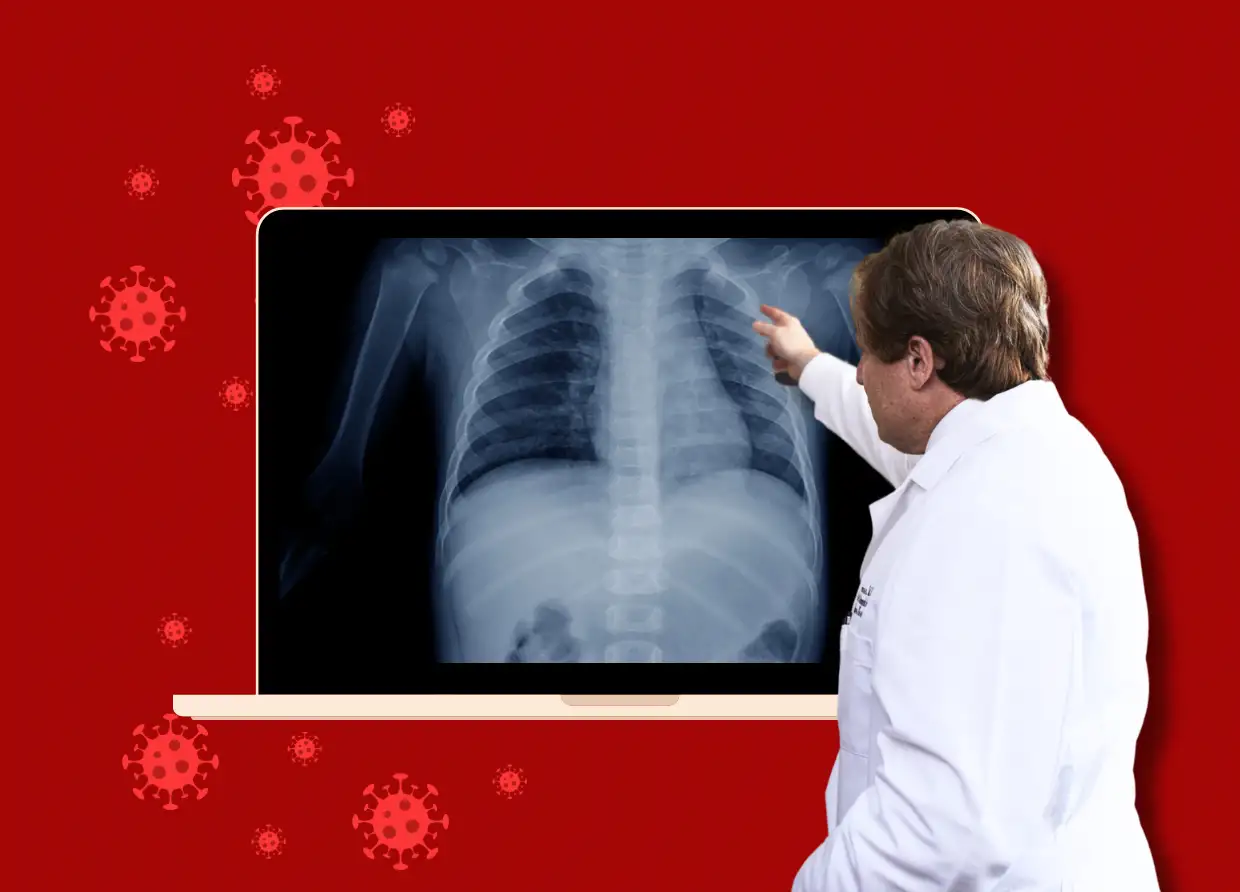 REVOLUTIONARY AI FROM UGM COULD CHANGE THE FIGHT AGAINST TUBERCULOSIS—HERE'S HOW